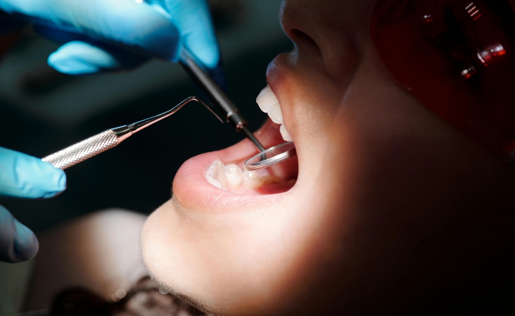 Managing Cavities is Like Oral Pest Control